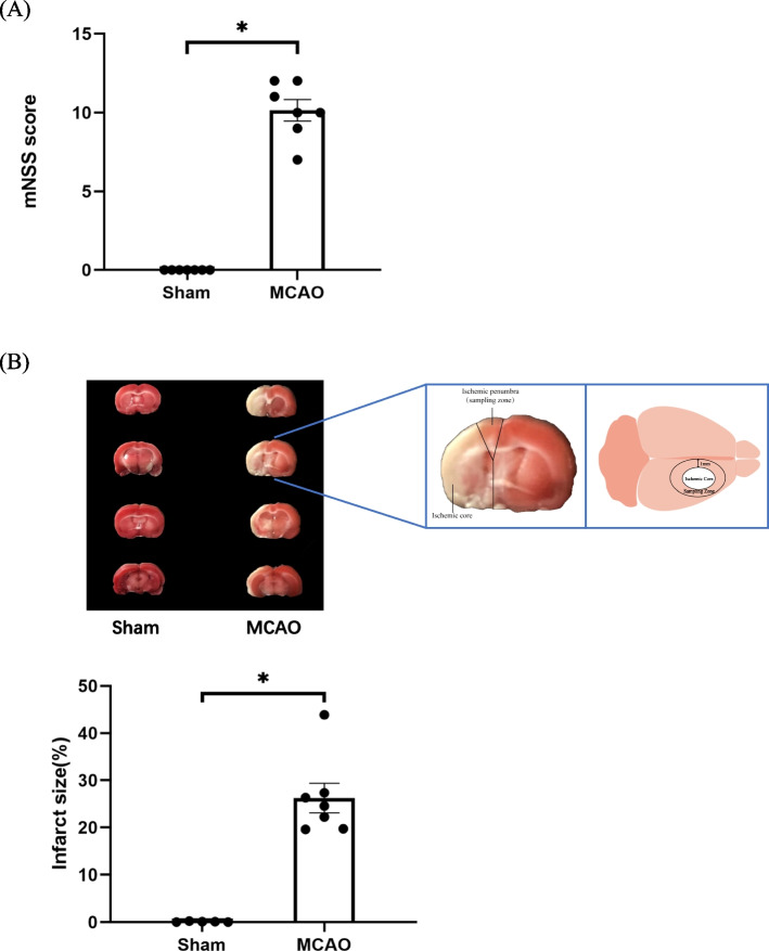 Comparative transcriptome findings reveal the neuroinflammatory network and potential biomarkers to early detection of ischemic stroke.