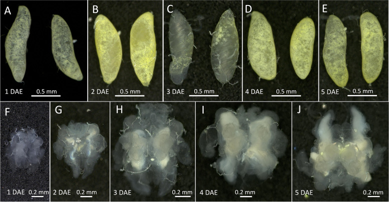 Morphology of the male reproductive system and sperm ultrastructure of the green lacewing, Chrysopa pallens (Rambur, 1838) (Neuroptera: Chrysopidae).