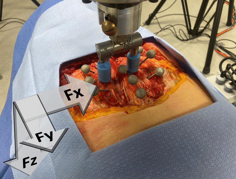 Investigation of the factors influencing spinal manipulative therapy force transmission through the thorax: a cadaveric study.