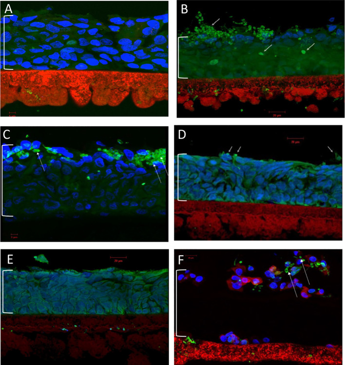 Antimicrobial effects of XF drugs against <i>Candida albicans</i> and its biofilms.