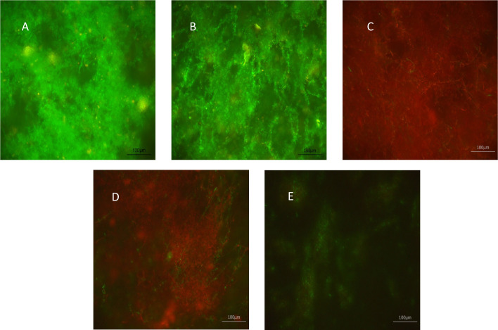 Antimicrobial effects of XF drugs against <i>Candida albicans</i> and its biofilms.