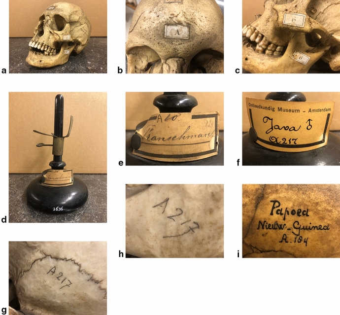 The Shelf Life of Skulls: Anthropology and 'race' in the Vrolik Craniological Collection.