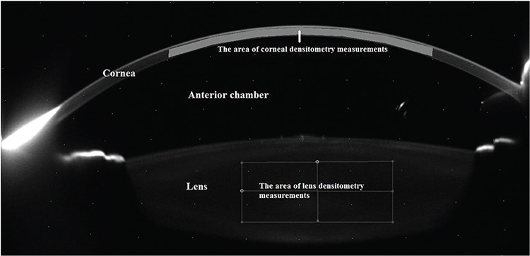 How Does Pupil Size Affect Lens and Corneal Densitometry Measured by Scheimpflug Tomography?