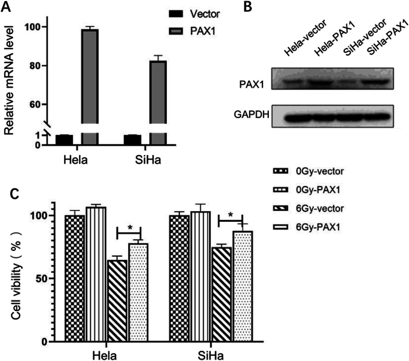 PAX1 hypomethylation as a prognostic biomarker for radioresistance of cervical cancer.