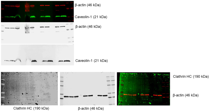 Upregulation of Caveolae-Associated Proteins in Lesional Samples of Hidradenitis Suppurativa: A Case Series Study