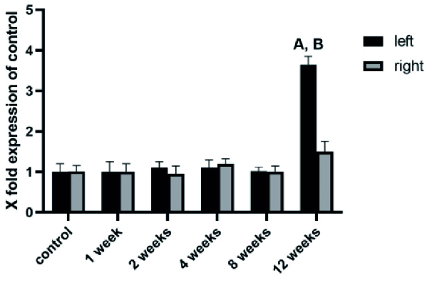 The time course of nod-like receptor family pyrin domain containing 3 inflammasome complex expressions in the testis tissue of an experimental varicocele rat model: An experimental study.