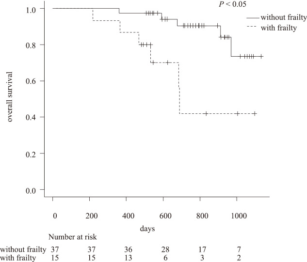 Preoperative frailty as a predictive factor for postoperative complications in patients with pancreatic cancer.