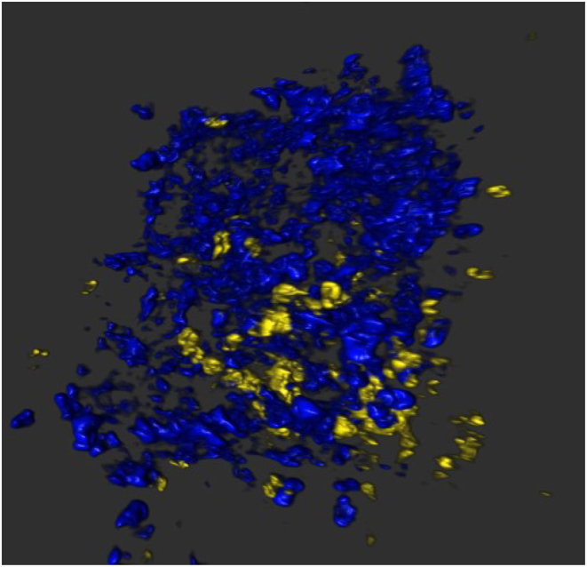 Islet cells in human type 1 diabetes: from recent advances to novel therapies - a symposium-based roadmap for future research.