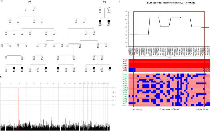 IHH enhancer variant within neighboring NHEJ1 intron causes microphthalmia anophthalmia and coloboma.