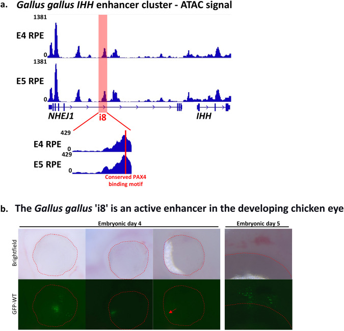 IHH enhancer variant within neighboring NHEJ1 intron causes microphthalmia anophthalmia and coloboma.