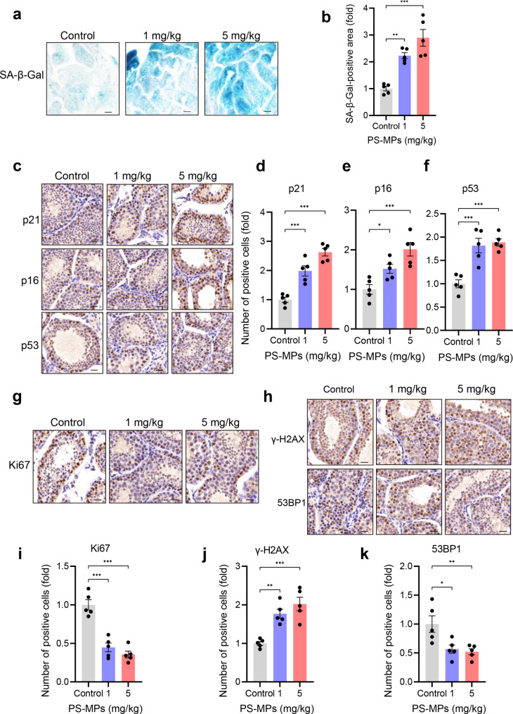 Long-term exposure to polystyrene microplastics triggers premature testicular aging.