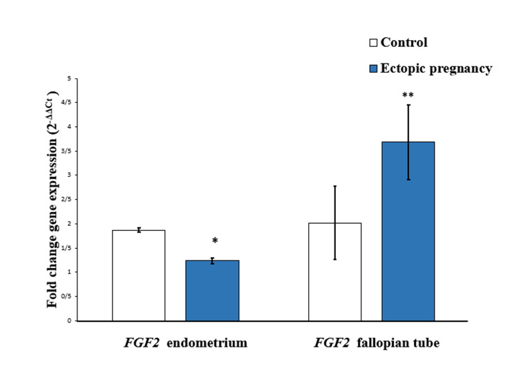 The Effect of Altered <i>Mucin1, FGF2,</i> and <i>HBEGF</i> Gene Expression at The Ectopic Implantation Site and Endometrial Tissues in The Tubal Pregnancy Pathogenesis: A Case-Control Study.