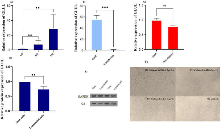 <i>GLUL</i> gene knockdown and restricted glucose level show synergistic inhibitory effect on the luminal subtype breast cancer MCF7 cells' proliferation and metastasis.