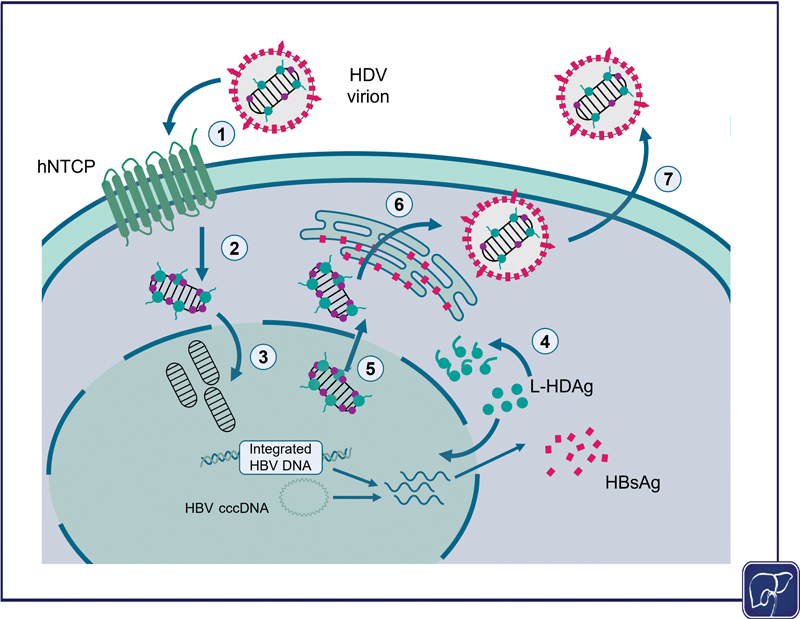 Hepatitis Delta Infection: A Clinical Review.