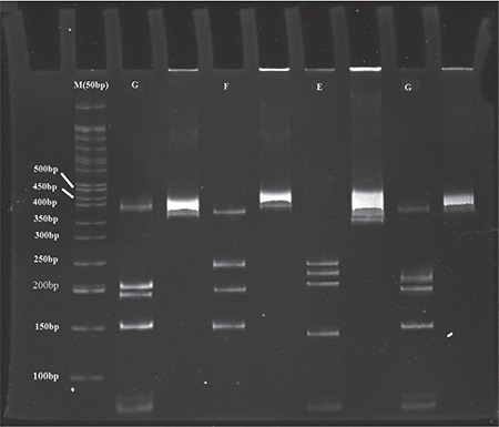 <i>Chlamydia trachomatis</i> Serovar Distribution in Patients with Follicular Conjunctivitis in Iran.