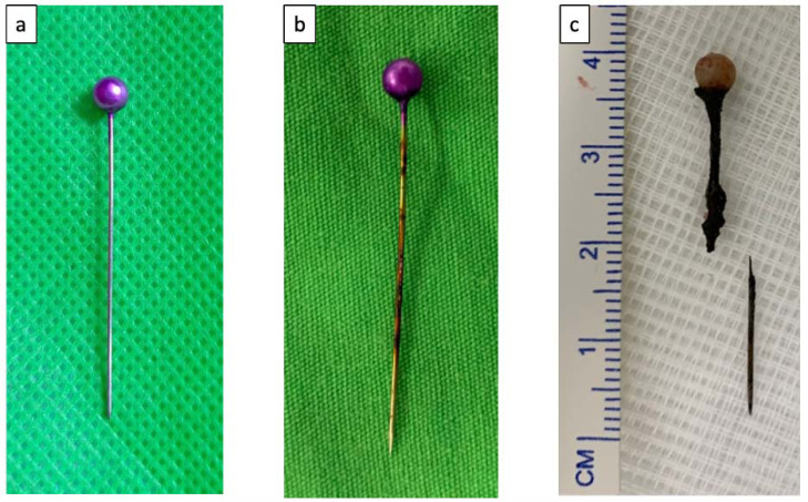 Role of Flexible Bronchoscopy using Biopsy Forceps as the Initial Attempt for Headscarf Pin Aspiration Extraction.