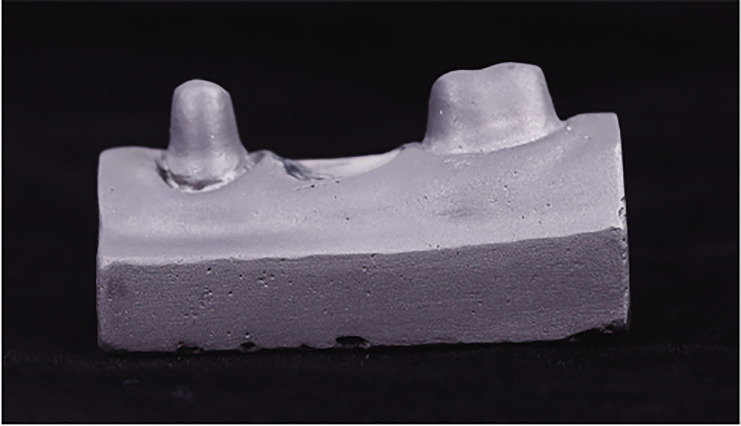 Effect of connector configuration on the fracture load in conventional and translucent zirconia three-unit fixed dental prostheses.