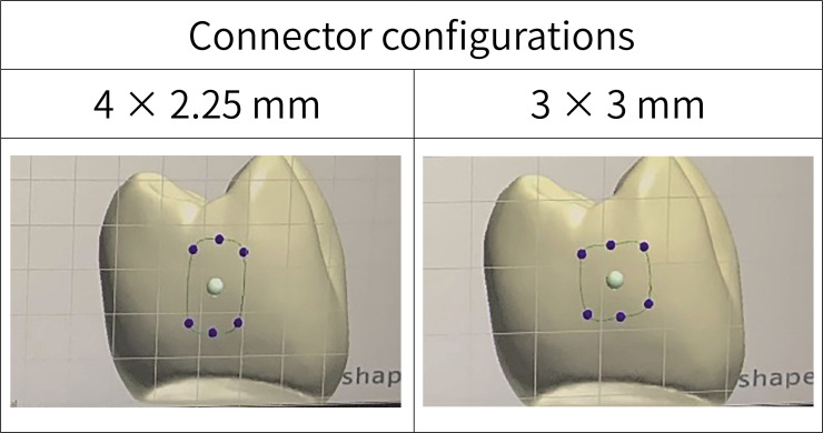 Effect of connector configuration on the fracture load in conventional and translucent zirconia three-unit fixed dental prostheses.