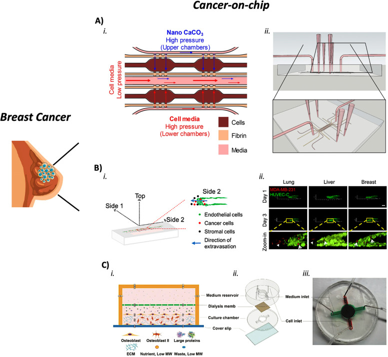 Cancer-on-chip: a 3D model for the study of the tumor microenvironment.