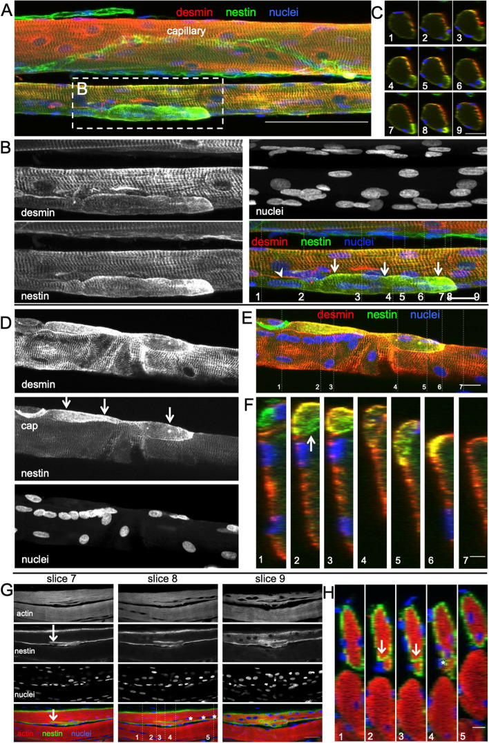 Fusion of myofibre branches is a physiological feature of healthy human skeletal muscle regeneration.