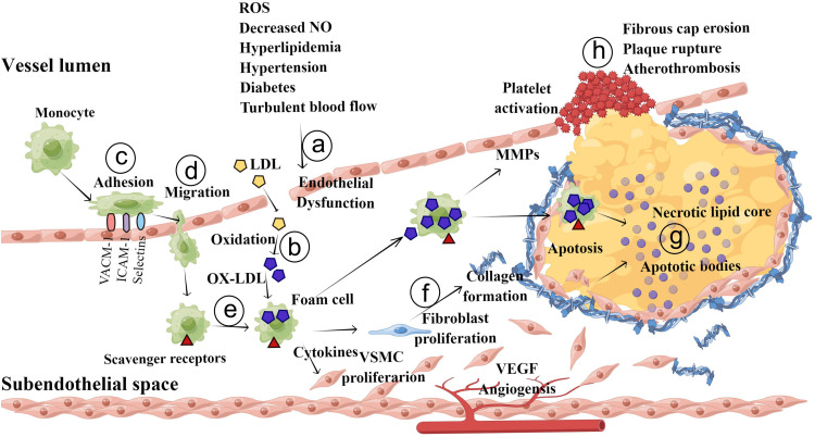 Role of neutrophils in different stages of atherosclerosis.