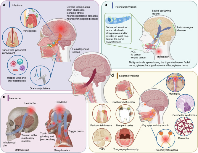 The interaction between the nervous system and the stomatognathic system: from development to diseases.