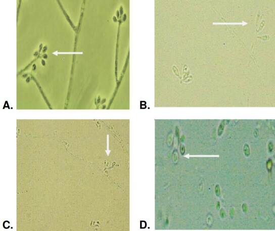 Phenotypic and genotypic characterization of Colombian clinical isolates of Sporothrix spp.