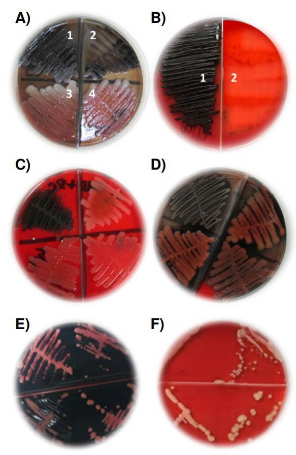 Fast and cost-effective protocol to produce Paracoccidioides spp. antigens