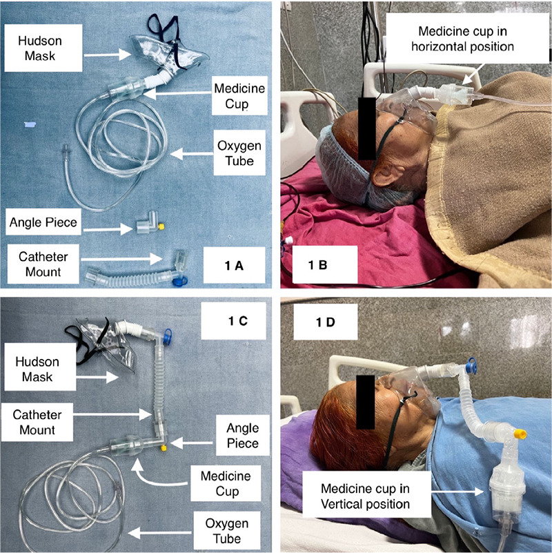 A Simple and Novel Modification of the Nebulization Mask to Improve Nebulization in the Supine Position.