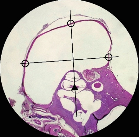 Effects of Particulate Matter Exposure on the Eustachian Tube and Middle Ear Mucosa of Rats.