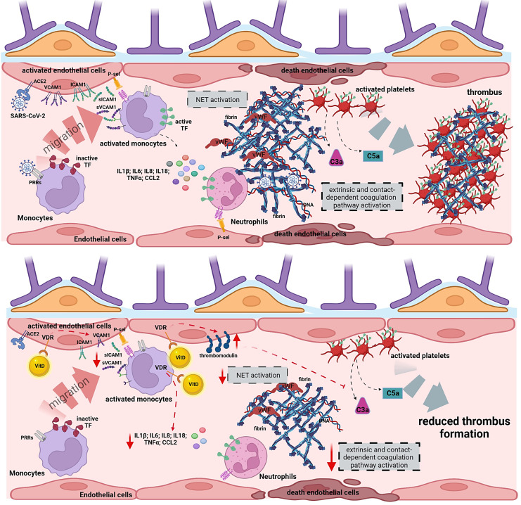 Understanding the Immune-Endocrine Effects of Vitamin D in SARS-CoV-2 Infection: A Role in Protecting against Neurodamage.