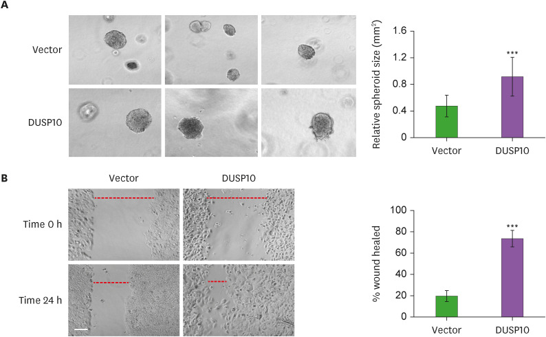 Tumor Promoting Function of DUSP10 in Non-Small Cell Lung Cancer Is Associated With Tumor-Promoting Cytokines.