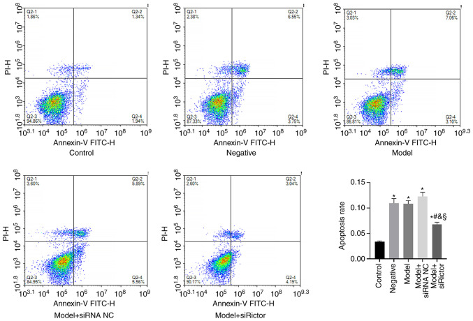 Effects and mechanism of Rictor interference in podocyte injury induced by high glucose.