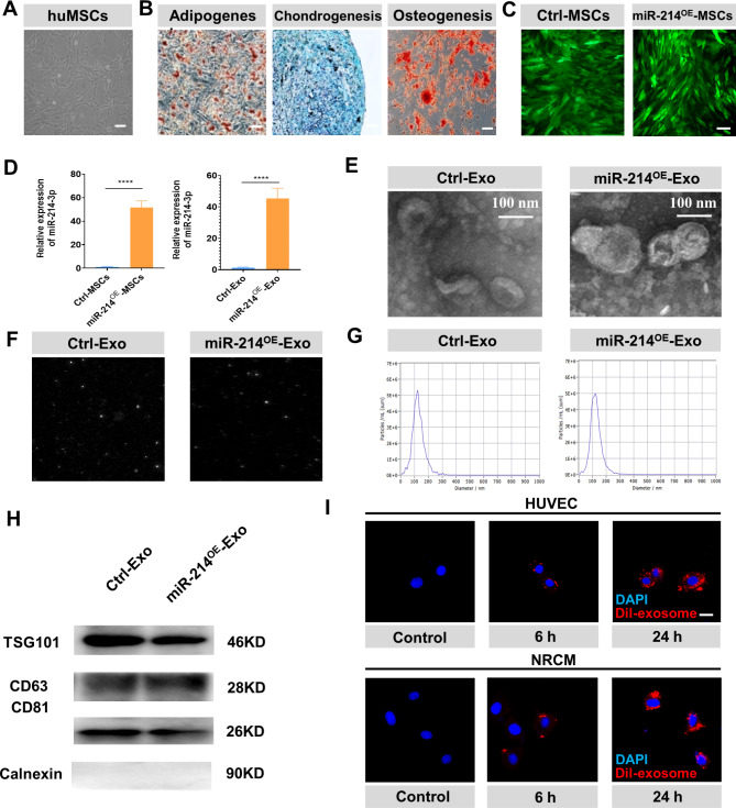 Exosomes derived from mir-214-3p overexpressing mesenchymal stem cells promote myocardial repair.