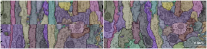 A novel registration method for long-serial section images of EM with a serial split technique based on unsupervised optical flow network.