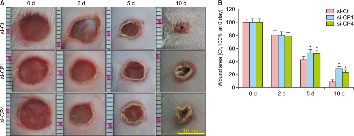 Knockdown of CPEB1 and CPEB4 Inhibits Scar Formation via Modulation of TAK1 and SMAD Signaling.