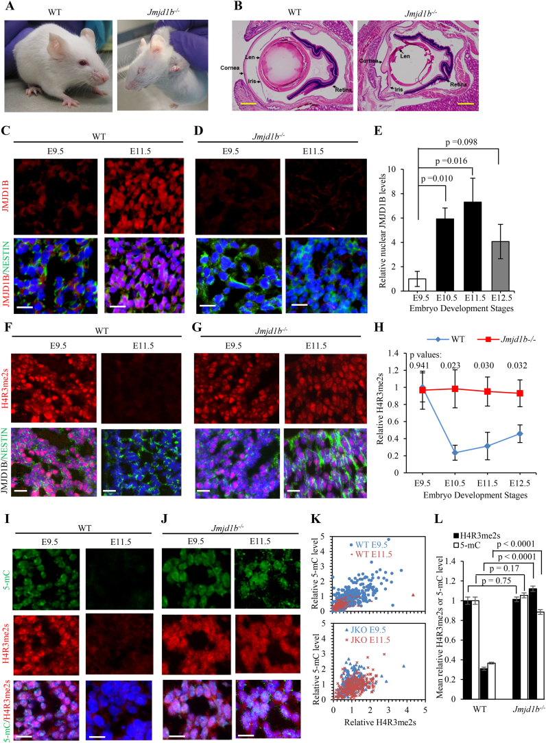 JMJD1B mediates H4R3me2s reprogramming to maintain DNA demethylation status in neural progenitor cells during embryonic development