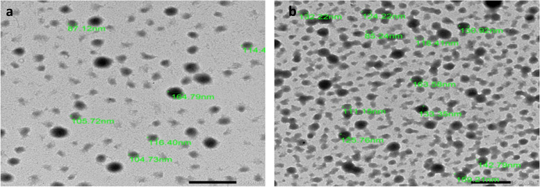 Berberine-loaded albumin nanoparticles reverse aflatoxin B1-induced liver hyperplasia.