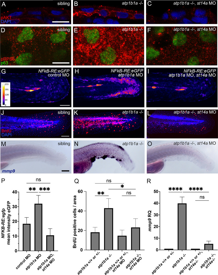 Matriptase-dependent epidermal pre-neoplasm in zebrafish embryos caused by a combination of hypotonic stress and epithelial polarity defects.