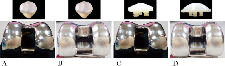 Factors that impact the patellofemoral contact stress in the TKA: a review.