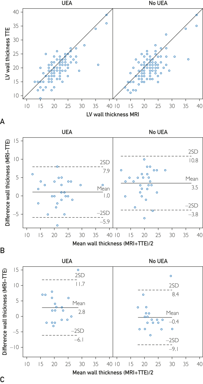 Ultrasound Enhancing Agents with Transthoracic Echocardiography for Maximal Wall Thickness in Hypertrophic Cardiomyopathy