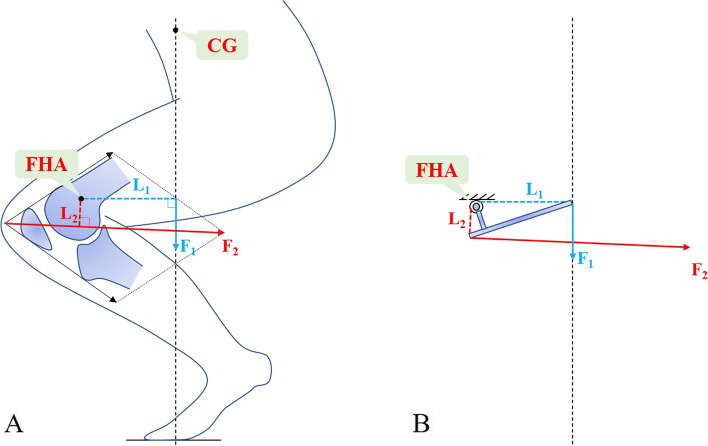 Factors that impact the patellofemoral contact stress in the TKA: a review.