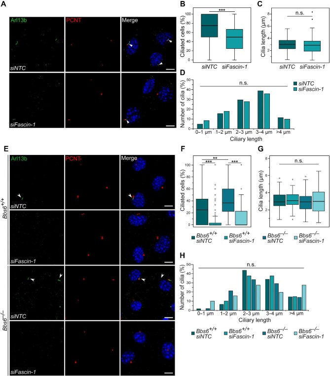 The actin-bundling protein Fascin-1 modulates ciliary signalling.