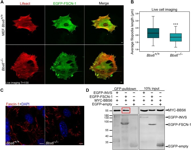 The actin-bundling protein Fascin-1 modulates ciliary signalling.