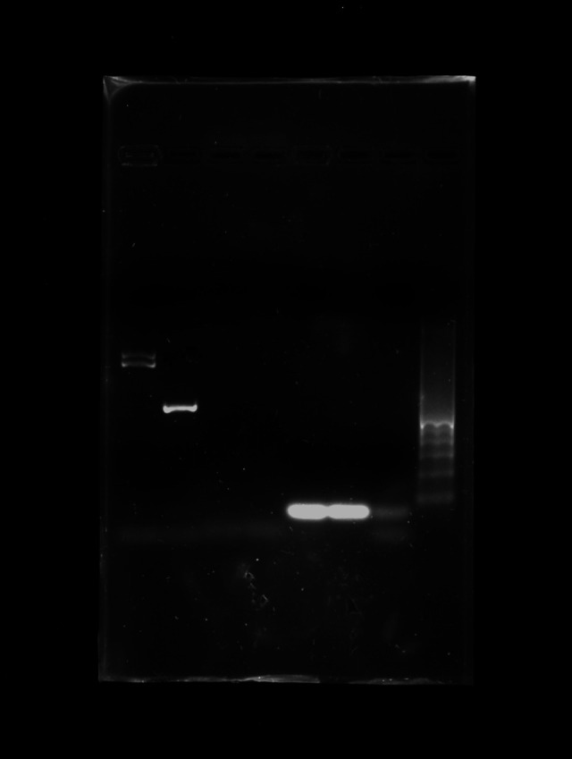 gDNA extraction from Candida albicans and Candida dubliniensis in subgingival samples in Argentina. Evaluation of different methods.