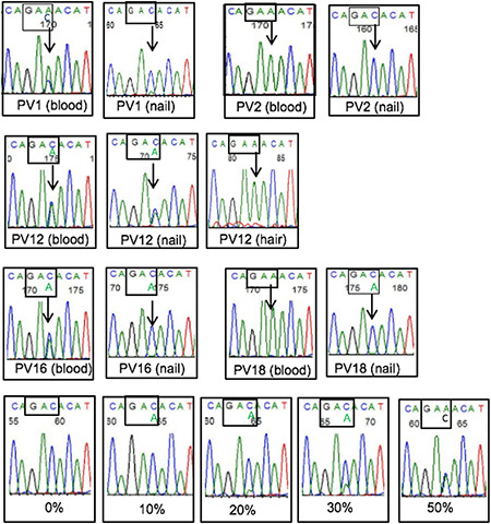 <i>JAK2</i> p.V617F Variants in Non-Blood DNA from Patients with Polycythemia Vera