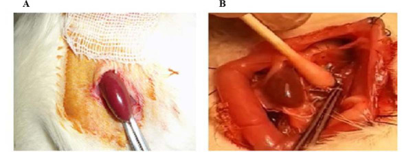 The role of Mas receptor on renal hemodynamic responses to angiotensin II administration in chronic renal sympathectomized male and female rats.