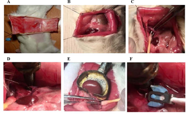 The role of Mas receptor on renal hemodynamic responses to angiotensin II administration in chronic renal sympathectomized male and female rats.