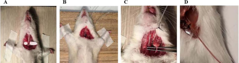 The role of Mas receptor on renal hemodynamic responses to angiotensin II administration in chronic renal sympathectomized male and female rats.