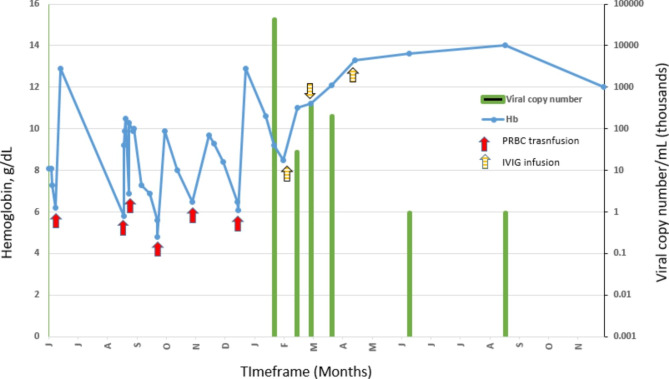 Intravenous immunoglobulin treatment of congenital parvovirus B19 induced anemia - a case report.